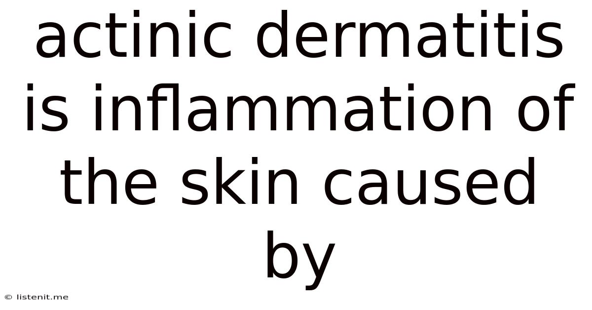 Actinic Dermatitis Is Inflammation Of The Skin Caused By