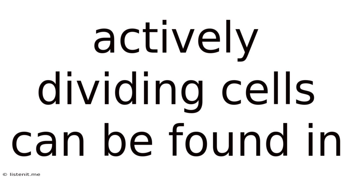 Actively Dividing Cells Can Be Found In