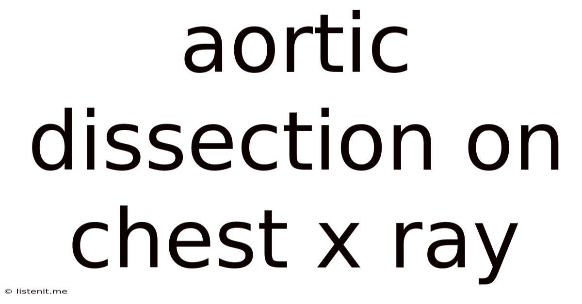 Aortic Dissection On Chest X Ray