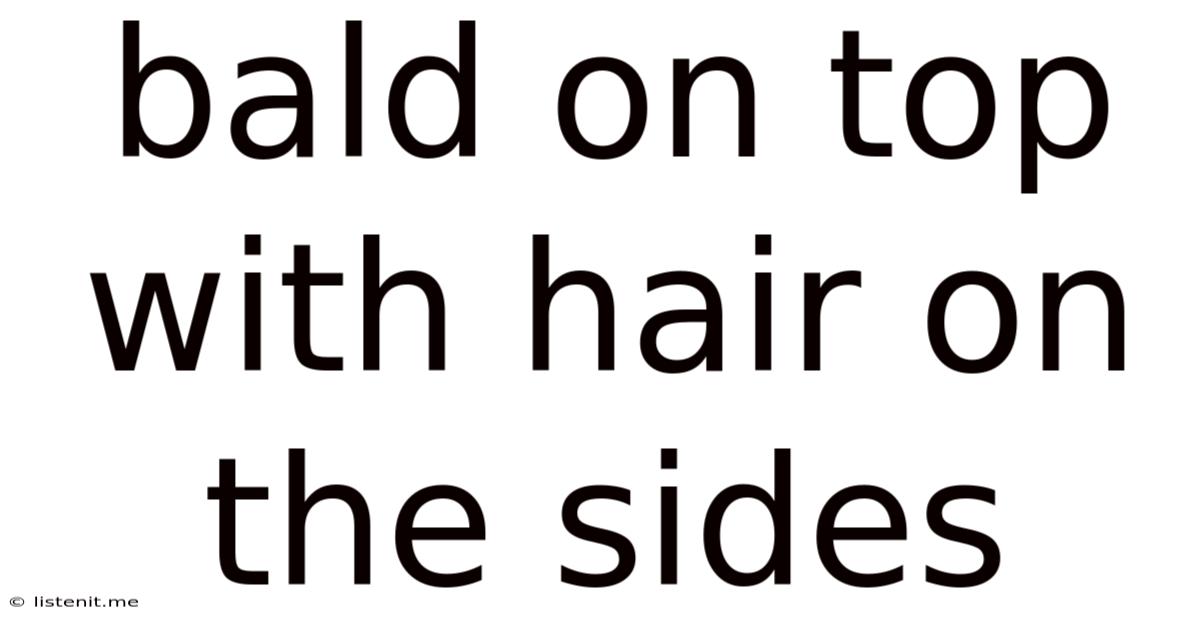Bald On Top With Hair On The Sides