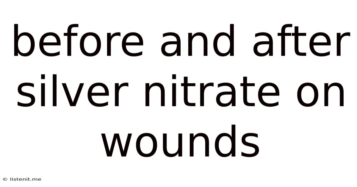 Before And After Silver Nitrate On Wounds