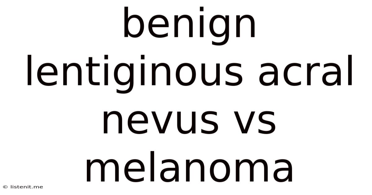 Benign Lentiginous Acral Nevus Vs Melanoma