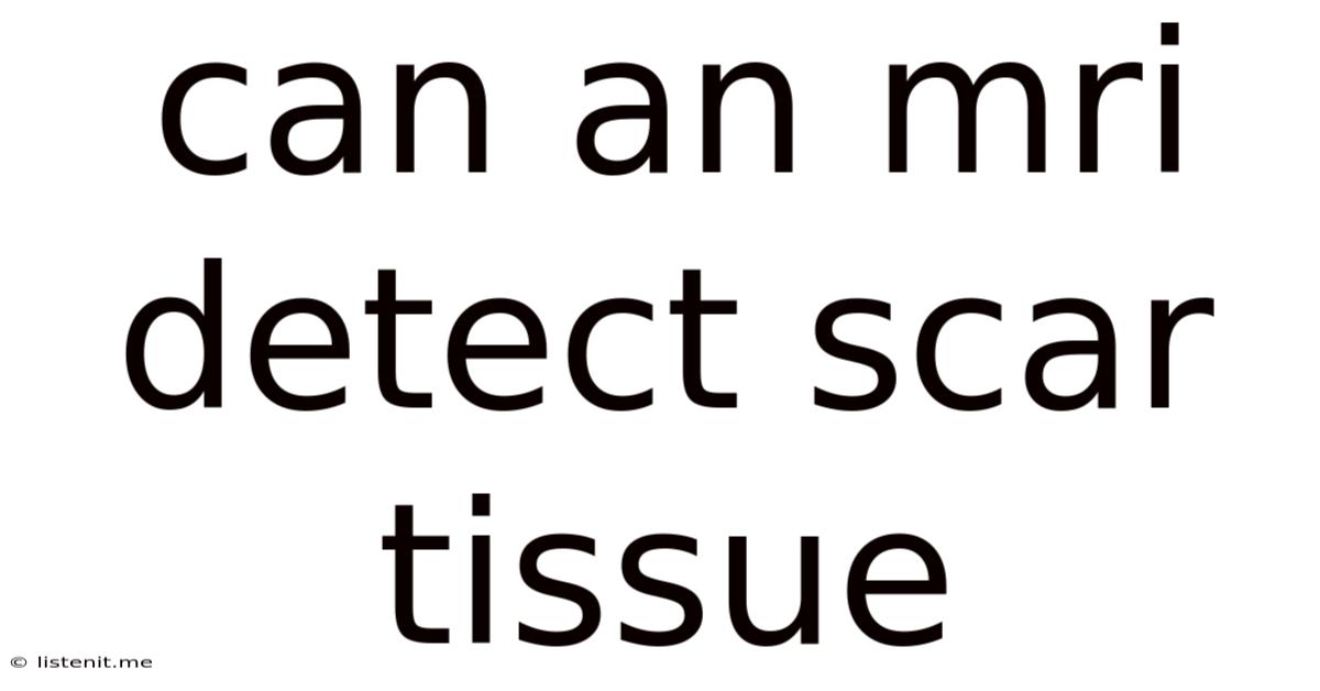 Can An Mri Detect Scar Tissue