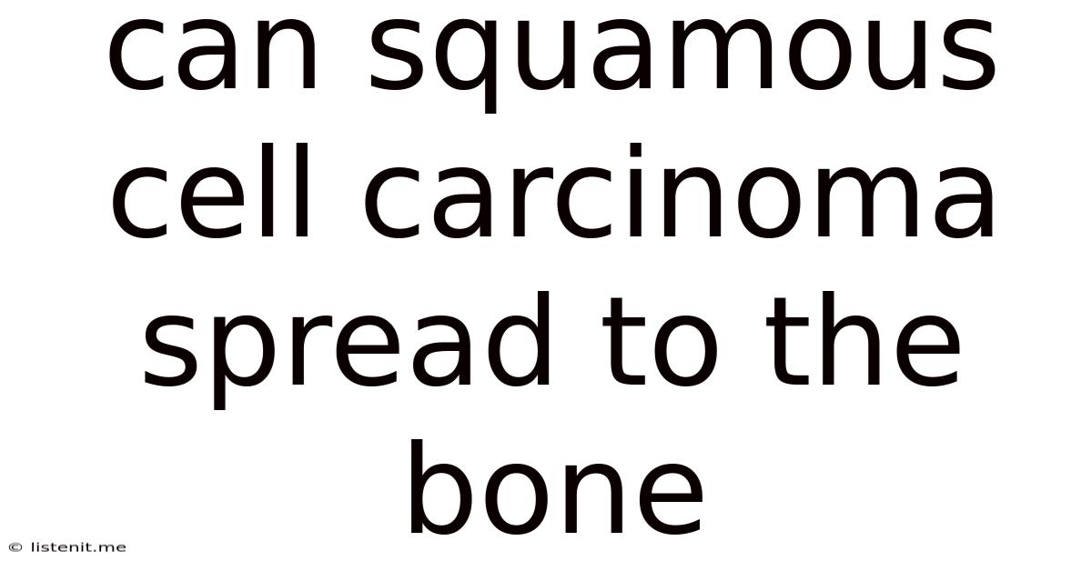 Can Squamous Cell Carcinoma Spread To The Bone