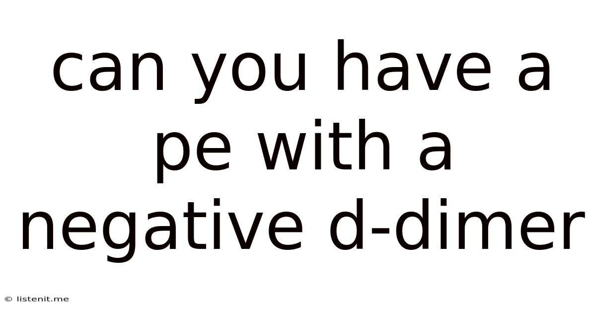 Can You Have A Pe With A Negative D-dimer