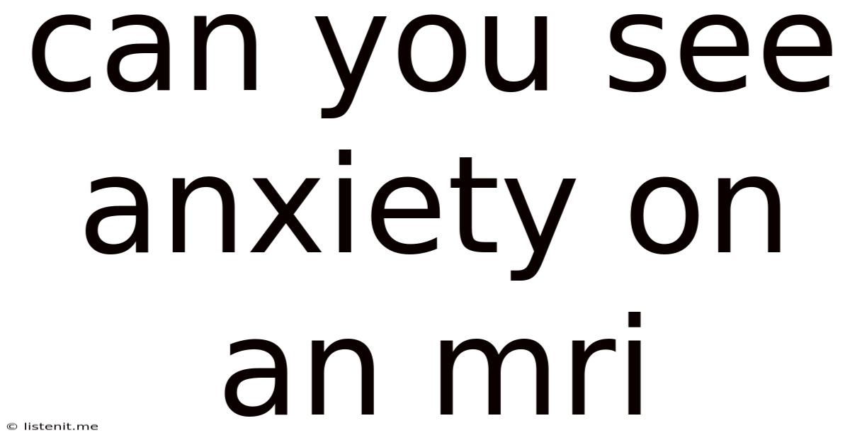 Can You See Anxiety On An Mri