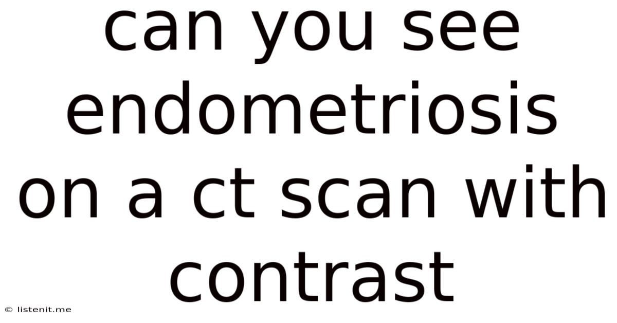 Can You See Endometriosis On A Ct Scan With Contrast