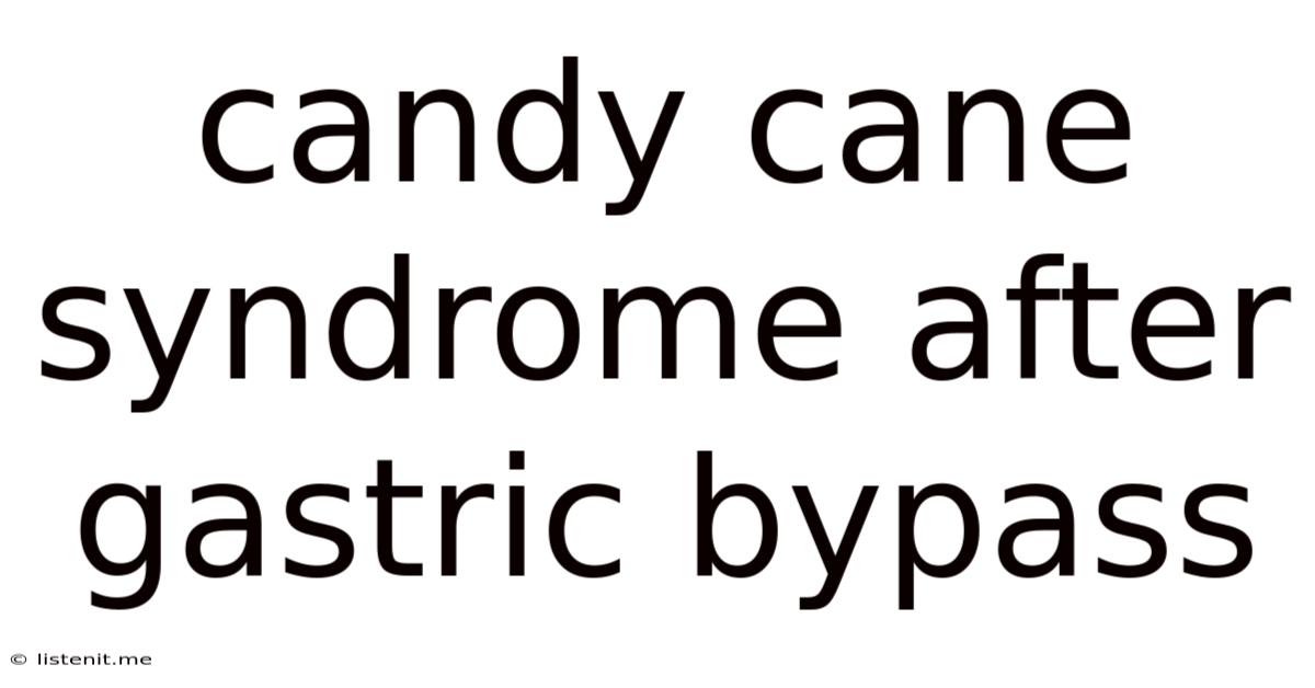Candy Cane Syndrome After Gastric Bypass