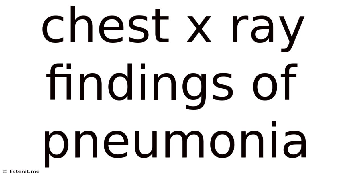 Chest X Ray Findings Of Pneumonia