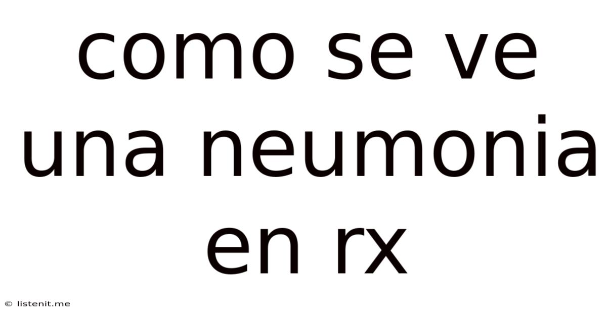 Como Se Ve Una Neumonia En Rx