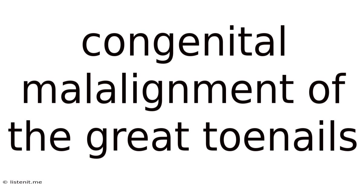 Congenital Malalignment Of The Great Toenails