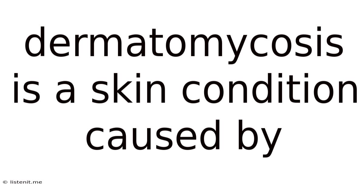 Dermatomycosis Is A Skin Condition Caused By