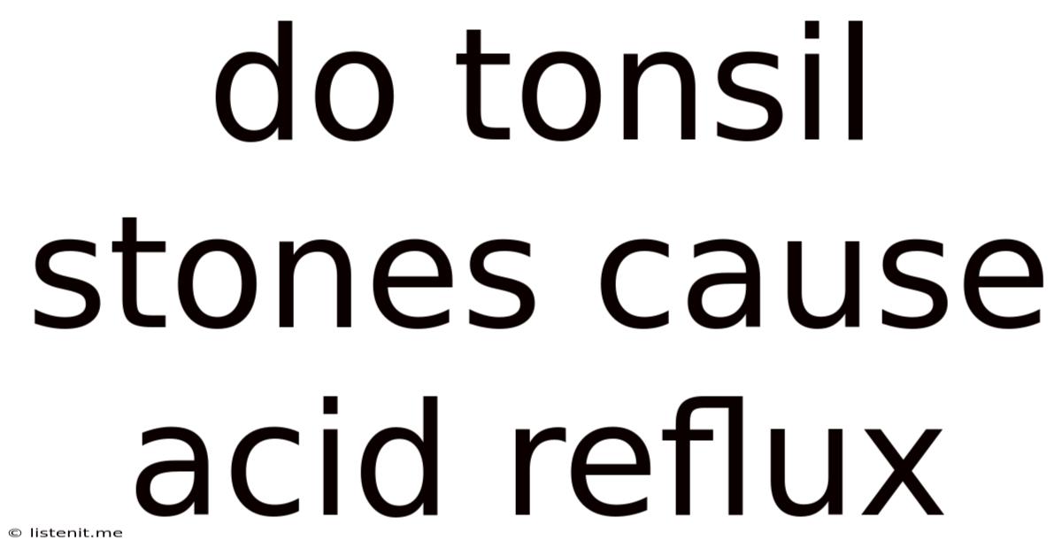 Do Tonsil Stones Cause Acid Reflux