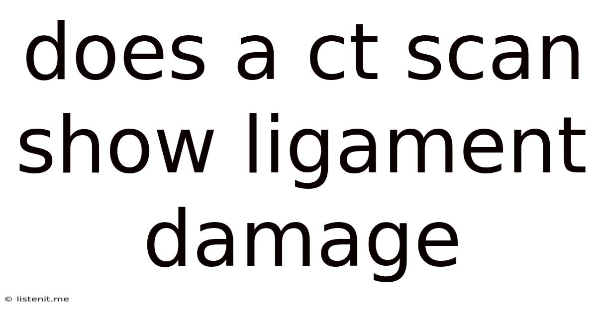 Does A Ct Scan Show Ligament Damage