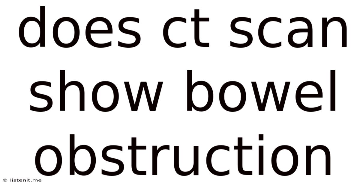 Does Ct Scan Show Bowel Obstruction