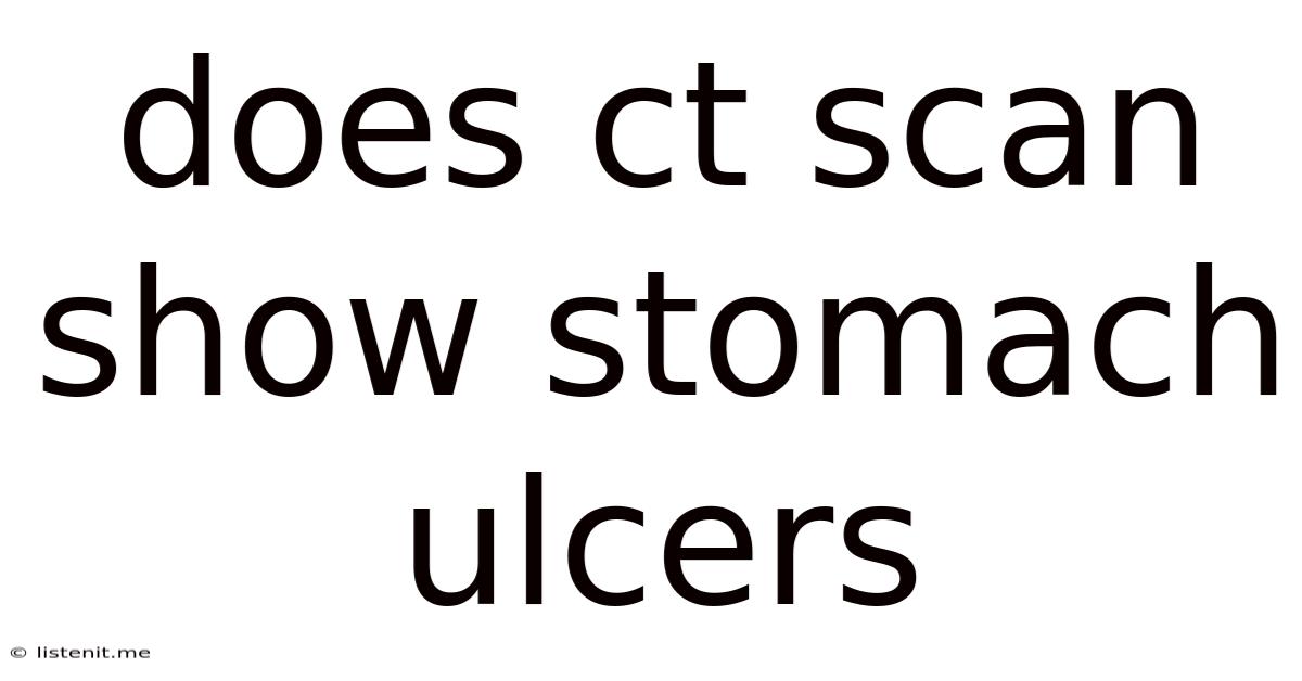 Does Ct Scan Show Stomach Ulcers