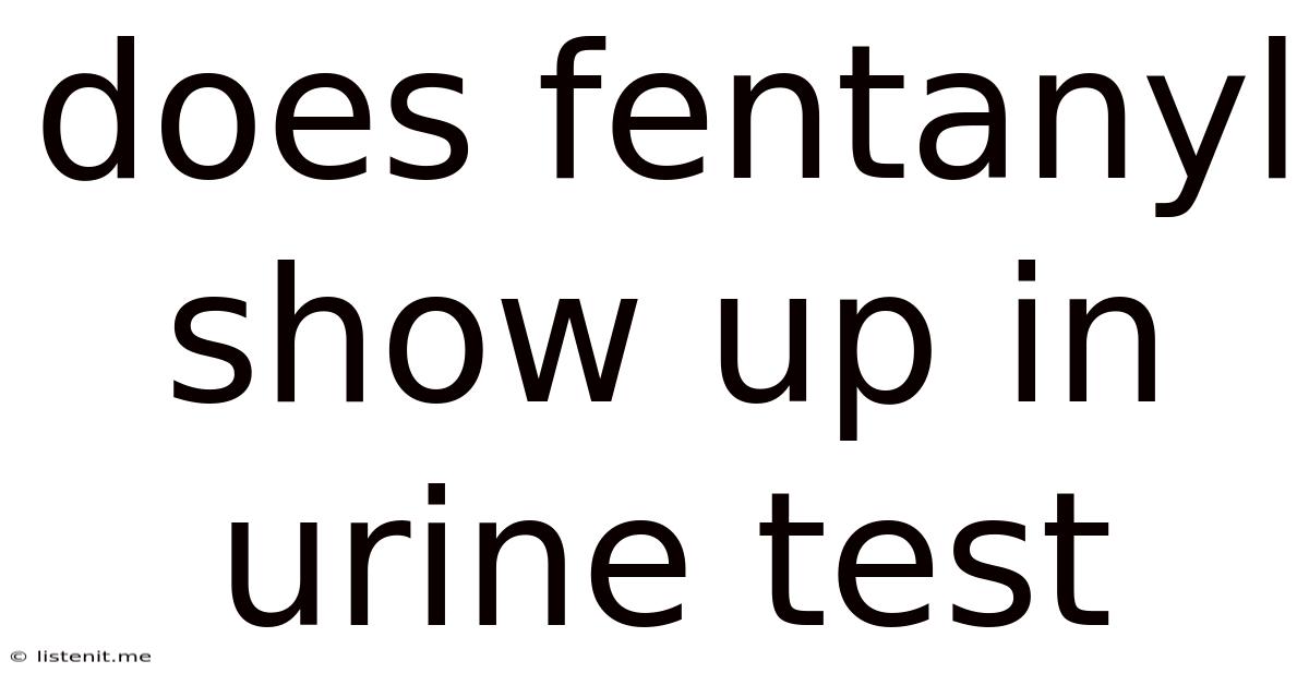 Does Fentanyl Show Up In Urine Test