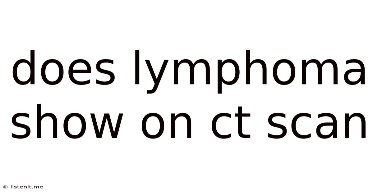 Does Lymphoma Show On Ct Scan
