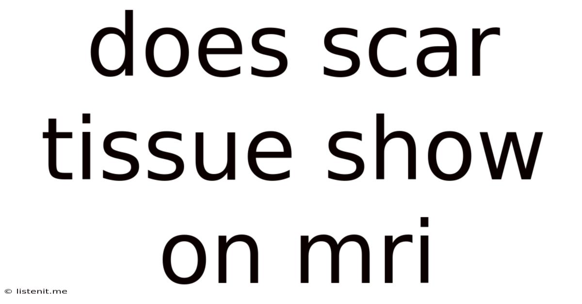 Does Scar Tissue Show On Mri
