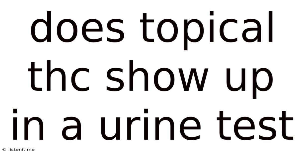 Does Topical Thc Show Up In A Urine Test
