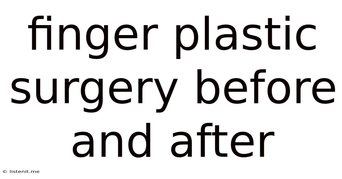 Finger Plastic Surgery Before And After