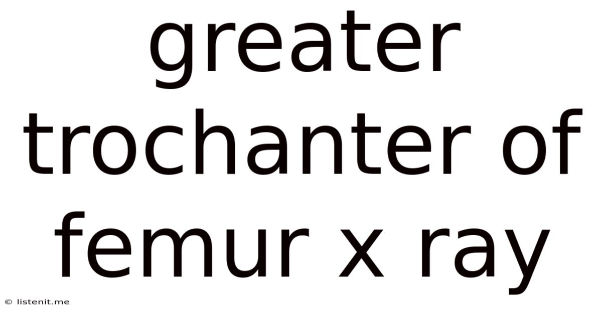 Greater Trochanter Of Femur X Ray