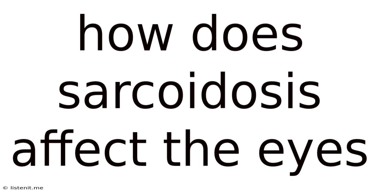How Does Sarcoidosis Affect The Eyes