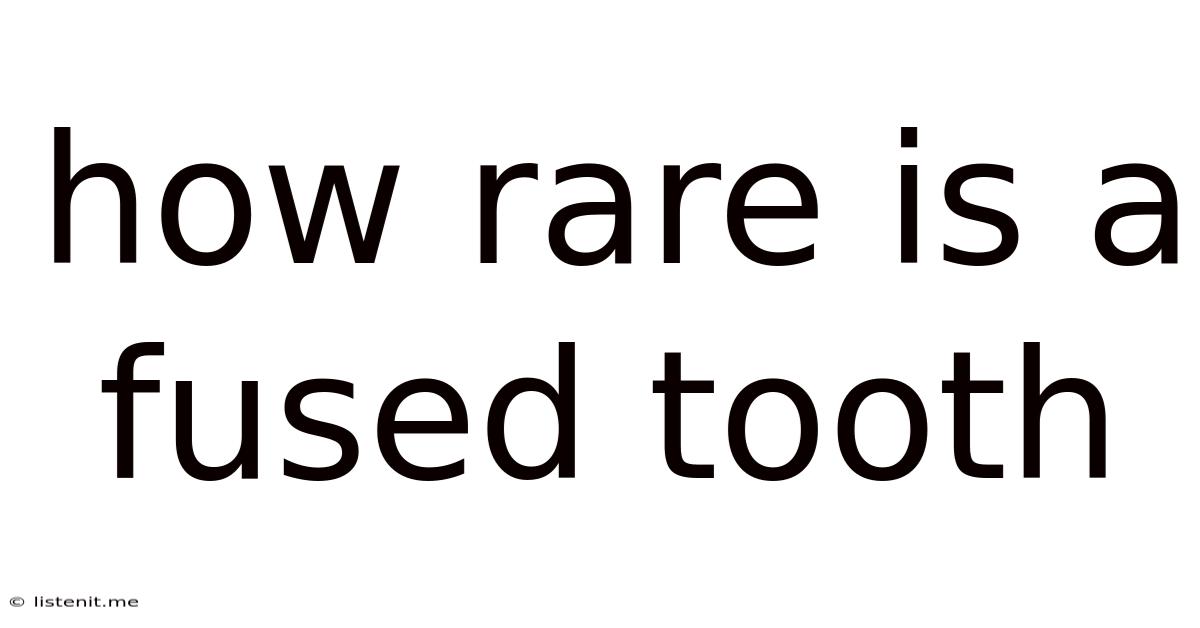 How Rare Is A Fused Tooth