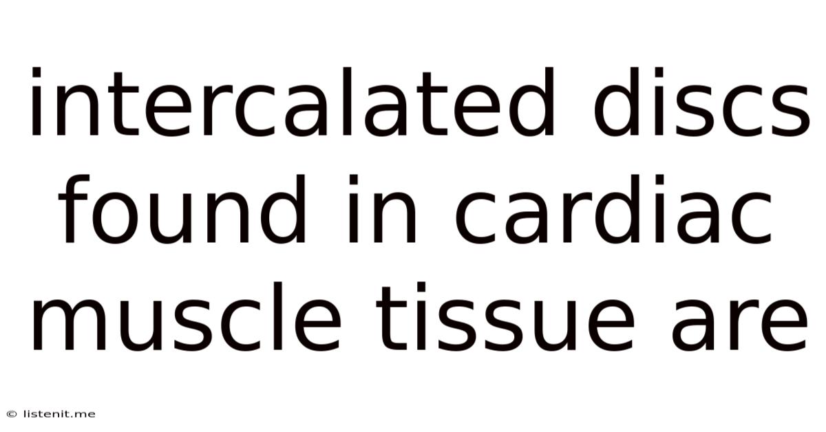 Intercalated Discs Found In Cardiac Muscle Tissue Are