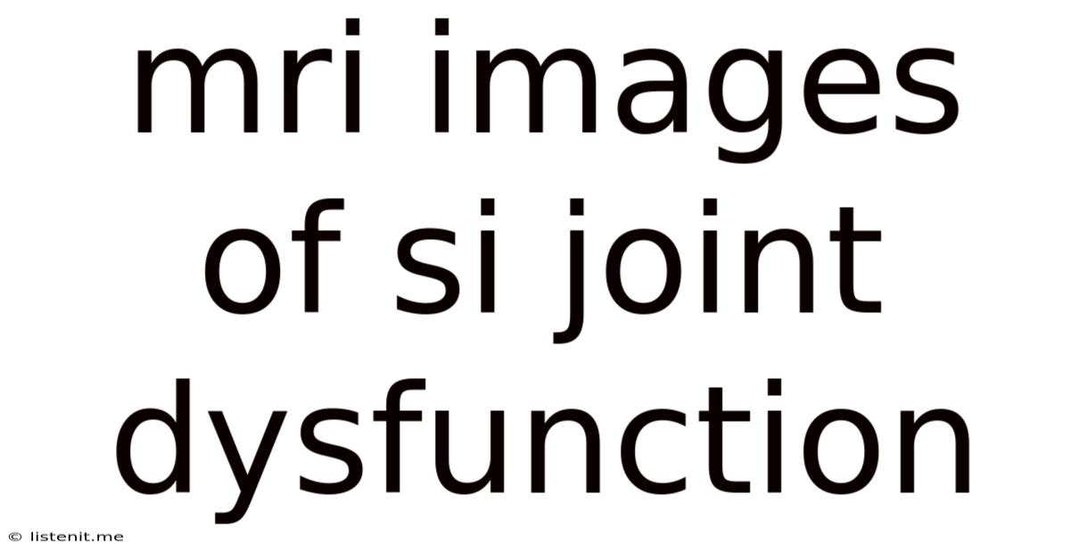 Mri Images Of Si Joint Dysfunction