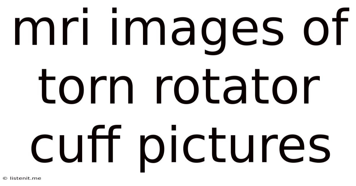Mri Images Of Torn Rotator Cuff Pictures