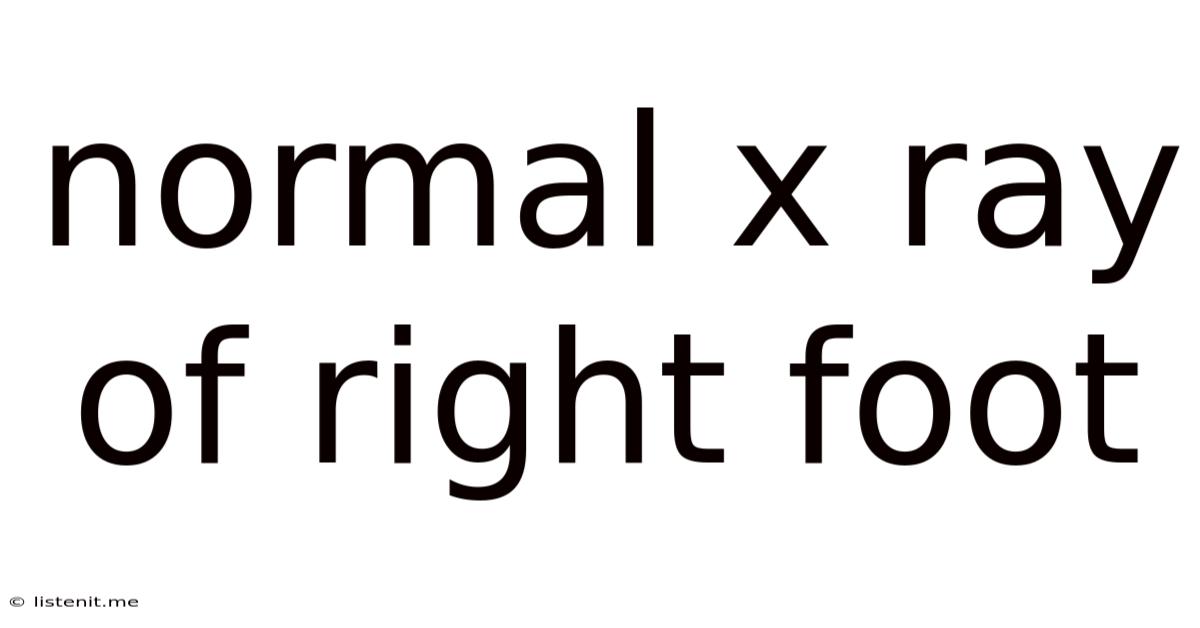 Normal X Ray Of Right Foot