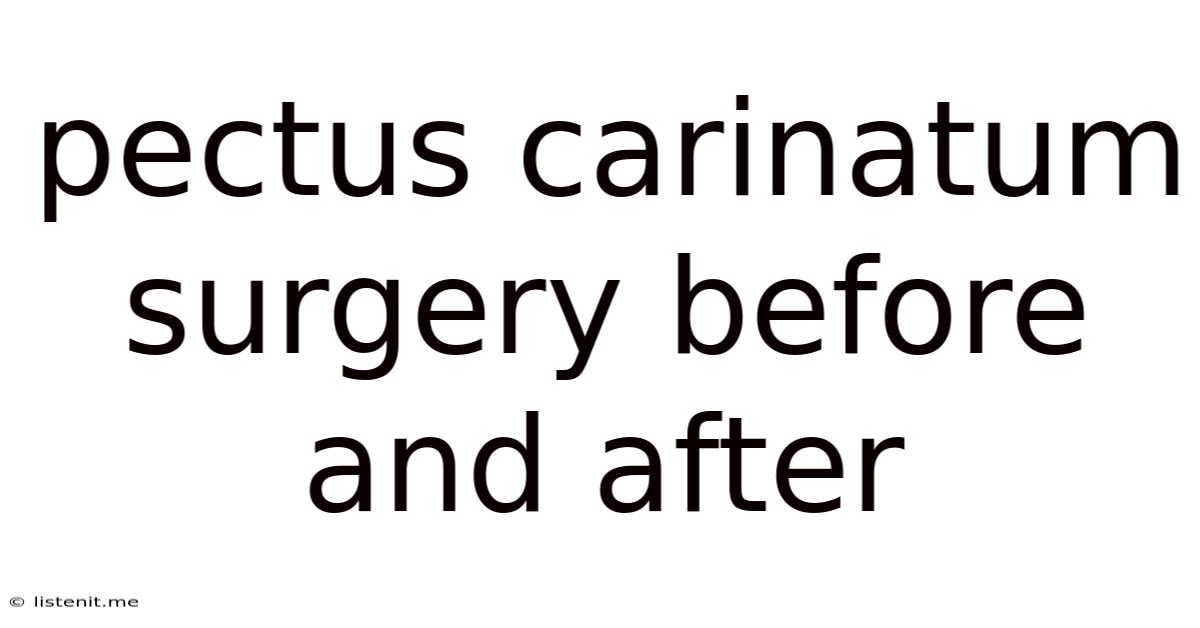 Pectus Carinatum Surgery Before And After