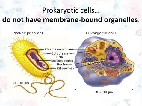 Prokaryotic Cells Do Not Have What