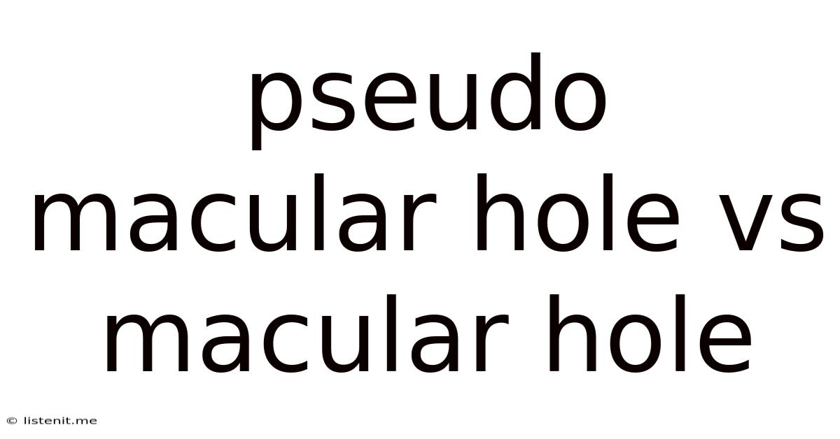 Pseudo Macular Hole Vs Macular Hole