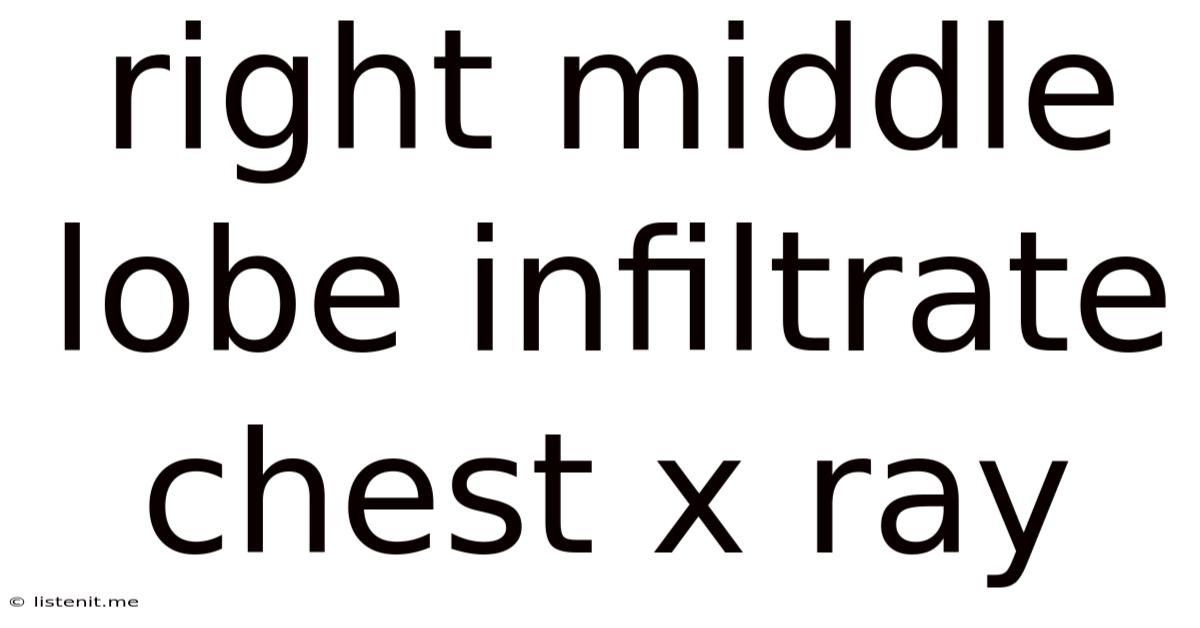 Right Middle Lobe Infiltrate Chest X Ray