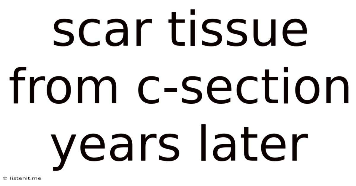 Scar Tissue From C-section Years Later