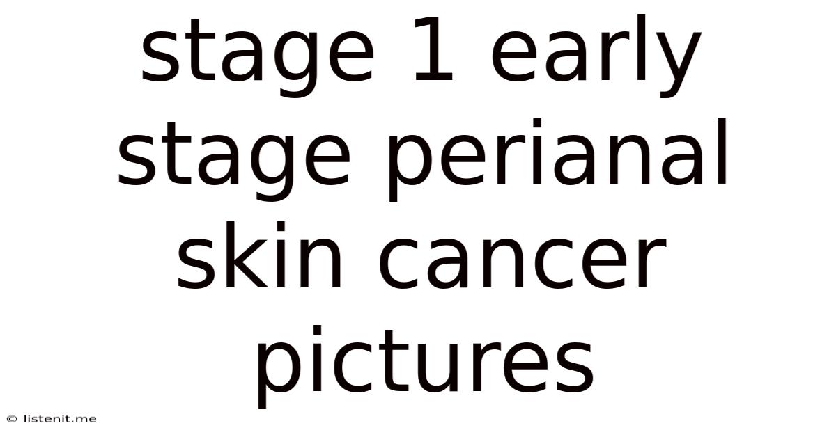 Stage 1 Early Stage Perianal Skin Cancer Pictures