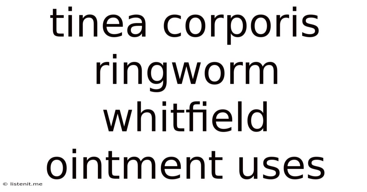 Tinea Corporis Ringworm Whitfield Ointment Uses