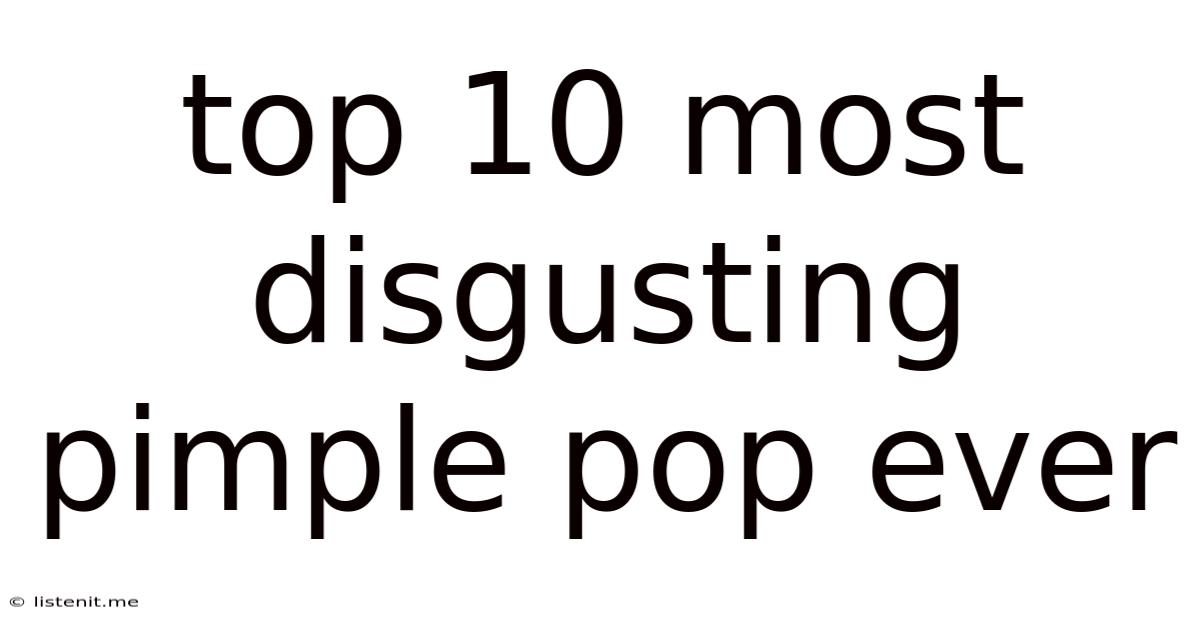 Top 10 Most Disgusting Pimple Pop Ever