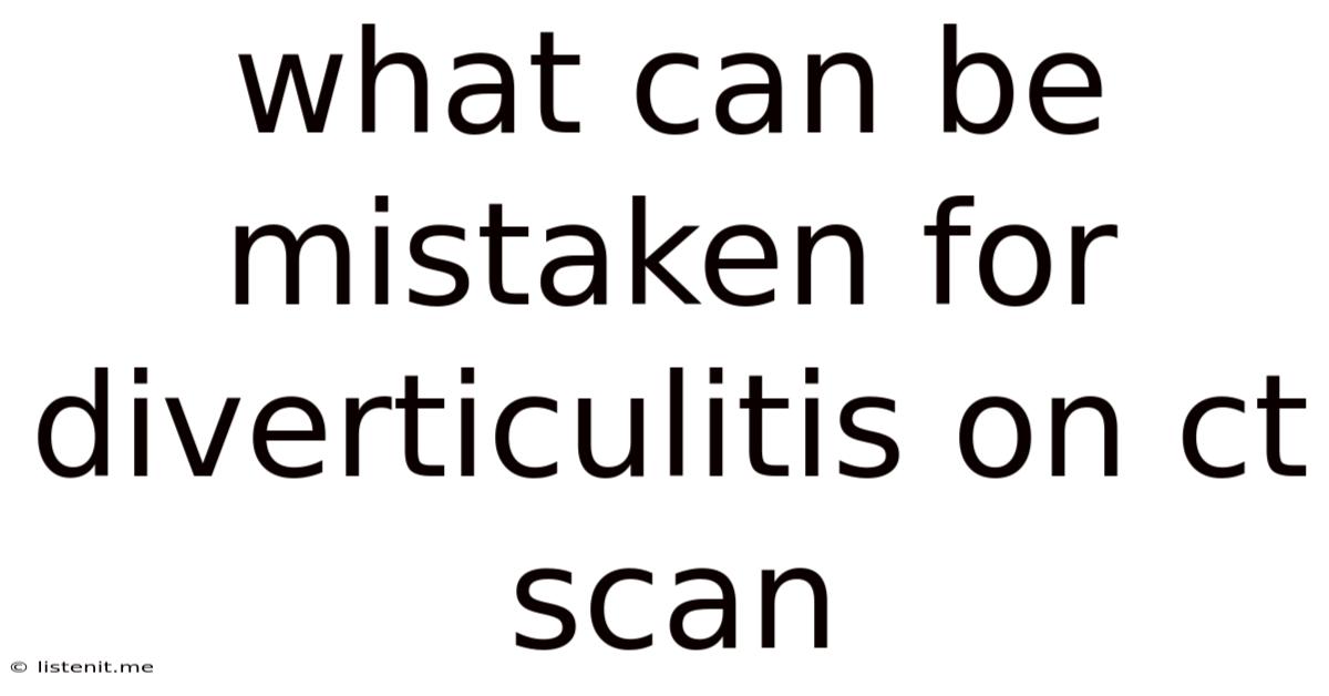 What Can Be Mistaken For Diverticulitis On Ct Scan