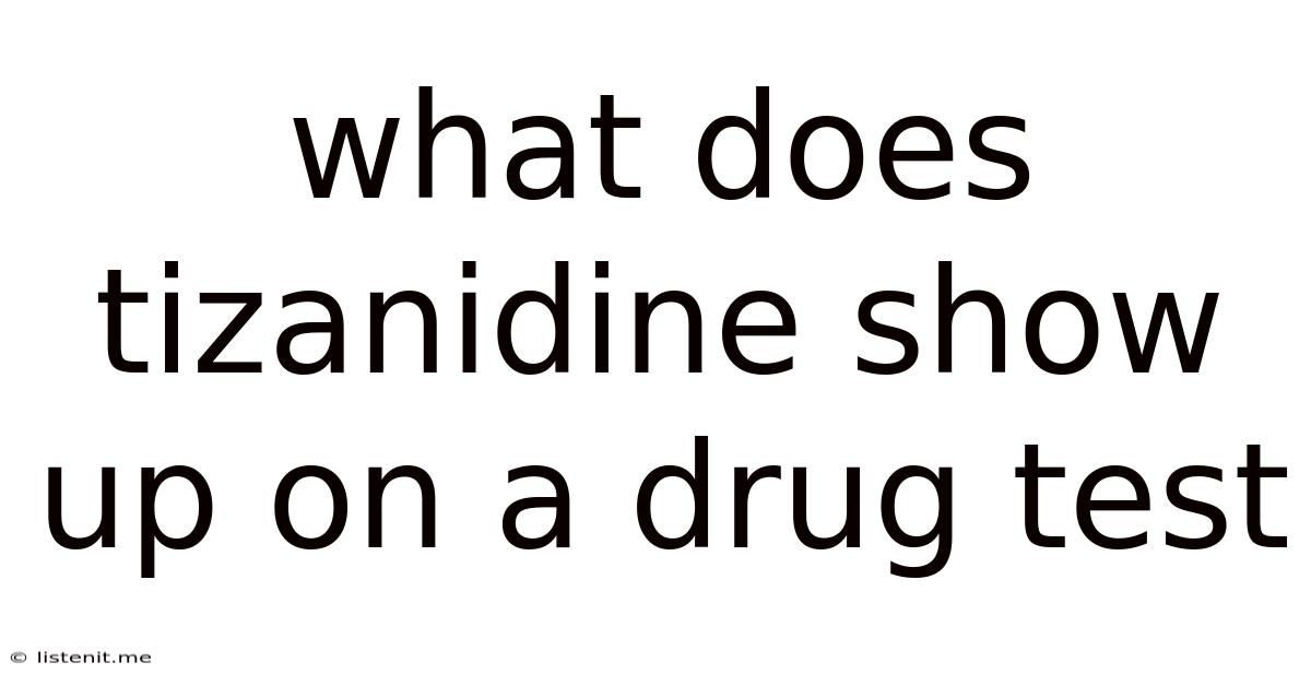 What Does Tizanidine Show Up On A Drug Test