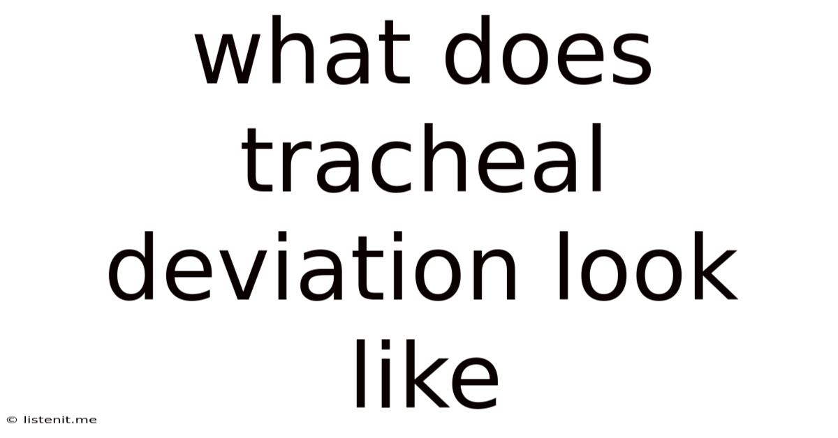 What Does Tracheal Deviation Look Like