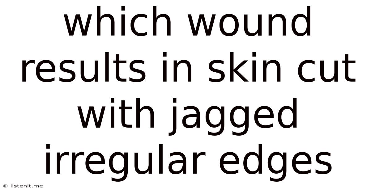 Which Wound Results In Skin Cut With Jagged Irregular Edges