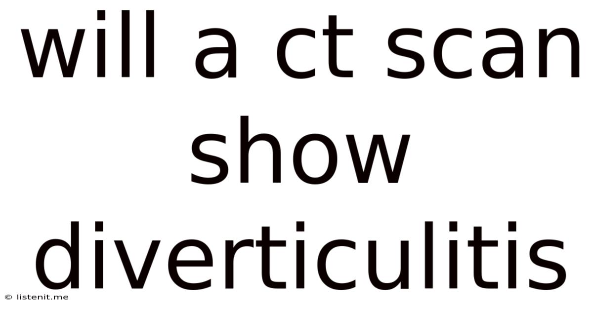 Will A Ct Scan Show Diverticulitis