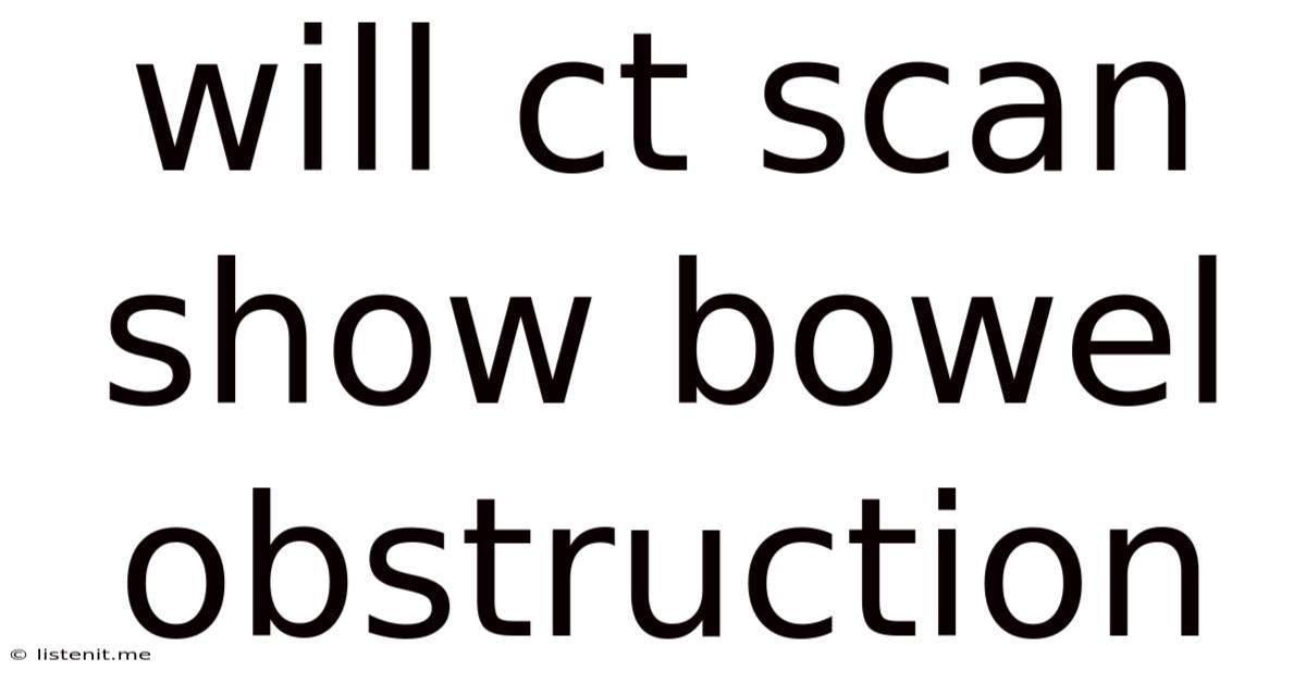 Will Ct Scan Show Bowel Obstruction
