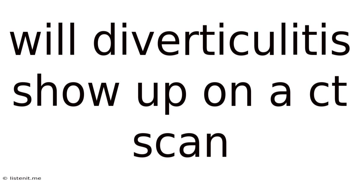 Will Diverticulitis Show Up On A Ct Scan