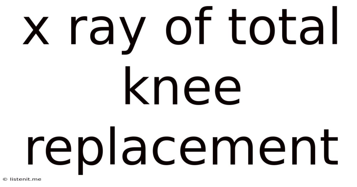 X Ray Of Total Knee Replacement